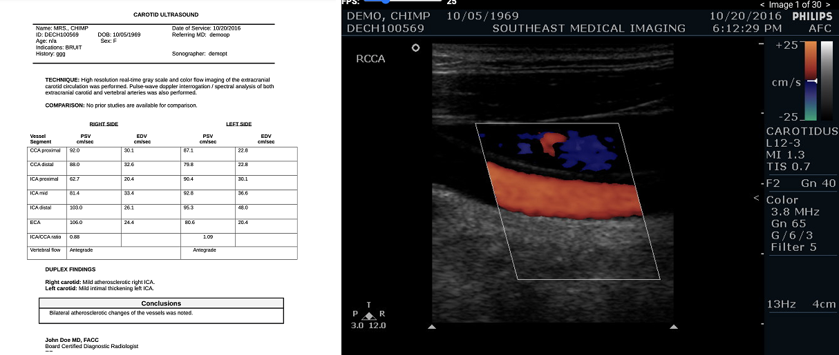 vascular ultrasound interpretation